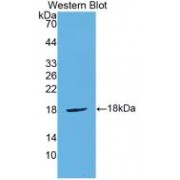 Western blot analysis of recombinant Mouse CTLA4 Protein.