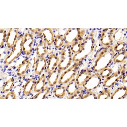 Cytotoxic T-Lymphocyte Associated Antigen 4 (CTLA4) Antibody