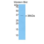 Western blot analysis of recombinant Human ENA78.