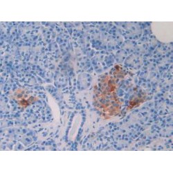 C-X-C Motif Chemokine 5 / ENA-78 (CXCL5) Antibody