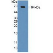 Western blot analysis of recombinant Human gABRa2 (with N-terminal His and GST tags).