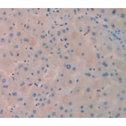 Phosphoenolpyruvate Carboxykinase, Cytosolic (PCK1) Antibody