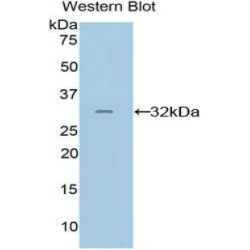 Programmed Cell Death Protein 1 Ligand 2 (PDCD1LG2) Antibody