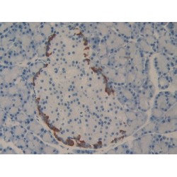Programmed Cell Death Protein 1 Ligand 2 (PDCD1LG2) Antibody