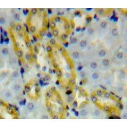 Aldehyde Dehydrogenase 1 Family, Member A3 (ALDH1A3) Antibody