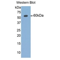 Aldehyde Dehydrogenase 7 Family, Member A1 (ALDH7A1) Antibody