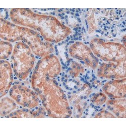 Aldehyde Dehydrogenase 7 Family, Member A1 (ALDH7A1) Antibody