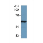 Western blot analysis of Rat Kidney lysate, using Mouse ALDH7A1 Antibody (1 µg/ml) and HRP-conjugated Goat Anti-Rabbit antibody (<a href="https://www.abbexa.com/index.php?route=product/search&amp;search=abx400043" target="_blank">abx400043</a>, 0.2 µg/ml).
