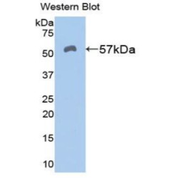 Aldehyde Dehydrogenase 7 Family, Member A1 (ALDH7A1) Antibody