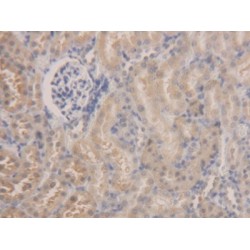 Aldehyde Dehydrogenase 7 Family, Member A1 (ALDH7A1) Antibody