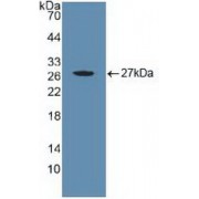 Western blot analysis of recombinant Human CYR61.