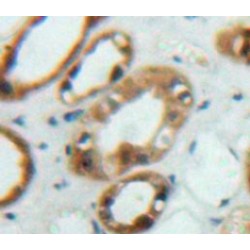 Fibroblast Growth Factor Receptor Substrate 2 (FRS2) Antibody