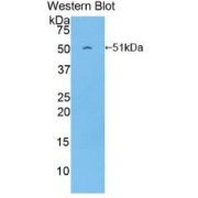 Western blot analysis of the recombinant protein.