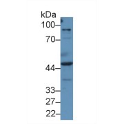 Western blot analysis of Human A549 cell lysate, using Human PRAME Antibody (2 µg/ml) and HRP-conjugated Goat Anti-Rabbit antibody (<a href="https://www.abbexa.com/index.php?route=product/search&amp;search=abx400043" target="_blank">abx400043</a>, 0.2 µg/ml).