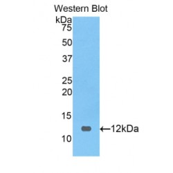 Melanoma Antigen Preferentially Expressed In Tumors (PRAME) Antibody