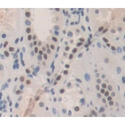 Melanoma Antigen Preferentially Expressed In Tumors (PRAME) Antibody