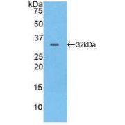 Western blot analysis of recombinant Human PTPRB.