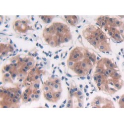 Protein Tyrosine Phosphatase Receptor Type B (PTPRB) Antibody