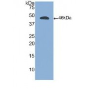 Western blot analysis of recombinant Human PTPRC.