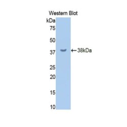 Receptor-Type Tyrosine-Protein Phosphatase C / CD45 (PTPRC) Antibody