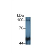 abx104381
