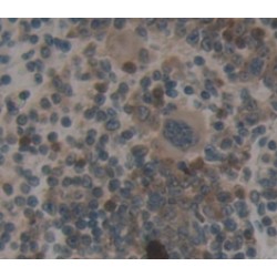 TNFRSF1A Associated Via Death Domain Protein (TRADD) Antibody