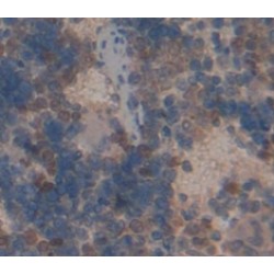TNFRSF1A Associated Via Death Domain Protein (TRADD) Antibody