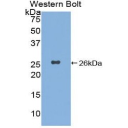 Xeroderma Pigmentosum, Complementation Group C (XPC) Antibody