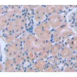 Xeroderma Pigmentosum, Complementation Group C (XPC) Antibody