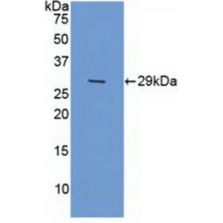 Xeroderma Pigmentosum, Complementation Group G (XPG) Antibody