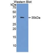 Western blot analysis of recombinant Human HSD17b1.