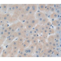Insulin Like Growth Factor Binding Protein 1 (IGFBP1) Antibody