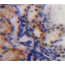 Insulin Like Growth Factor Binding Protein 2 (IGFBP2) Antibody