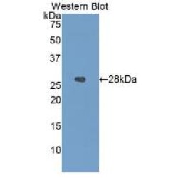 Insulin Like Growth Factor Binding Protein 4 (IGFBP4) Antibody