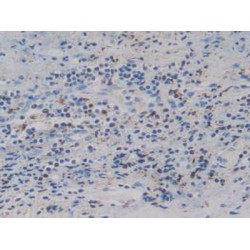 Insulin Like Growth Factor Binding Protein 4 (IGFBP4) Antibody