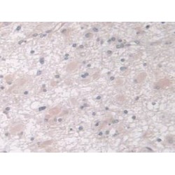 Insulin Like Growth Factor Binding Protein 4 (IGFBP4) Antibody