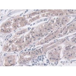 Insulin Like Growth Factor Binding Protein 4 (IGFBP4) Antibody