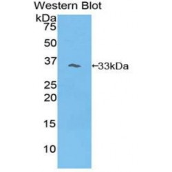 Phosphoinositide-3-Kinase Adaptor Protein 1 (PIK3AP1) Antibody