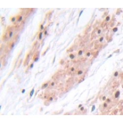 Phosphoinositide-3-Kinase Adaptor Protein 1 (PIK3AP1) Antibody