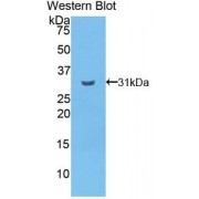 Western blot analysis of the recombinant Human CELSR2 protein.