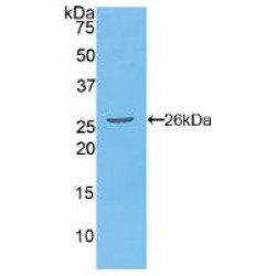 Fas Associating Death Domain Containing Protein (FADD) Antibody