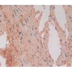 Fas Associating Death Domain Containing Protein (FADD) Antibody