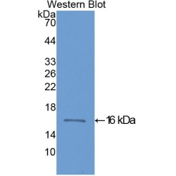 Fatty Acid Binding Protein 3, Muscle And Heart (FABP3) Antibody