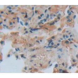 Fc Fragment of IgG Low Affinity IIIa Receptor (FCGR3A) Antibody