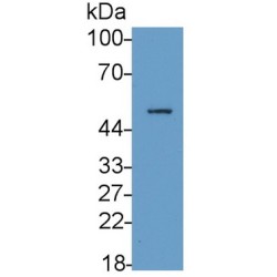 Fc Fragment of IgG Low Affinity IIIa Receptor (FCGR3A) Antibody