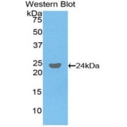 Western blot analysis of the recombinant protein.