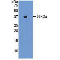 Integrin Alpha-L (ITGAL) Antibody
