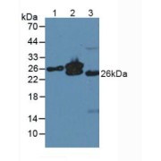 Western blot analysis of (1) Human Liver Tissue, (2) Mouse Heart Tissue and (3) Mouse Skeletal Muscle Tissue.