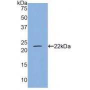 Western blot analysis of recombinant Mouse MYL4.