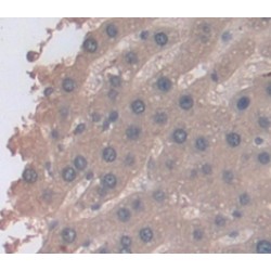 Receptor Interacting Serine Threonine Kinase 3 (RIPK3) Antibody